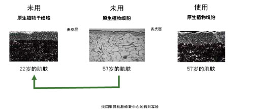 使用一个月后，57岁的肌肤表皮厚度能够回复到媲美22岁的表皮层状态